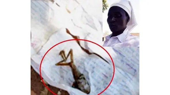 این زن 8 ماهه باردار بچه قورباغه زایمان کرد+عکس