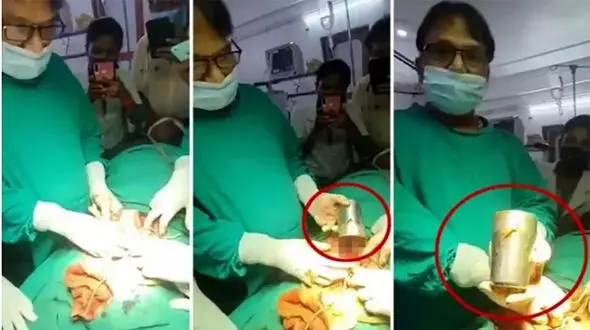 شوک آقای دکتر از معده یک بیمار ! + عکس واقعا عجیب و باورنکردنی !