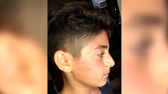 جنجال سیلی محکم معلم به صورت طاها  / پدر پارس آبادی شکایت کرد ! + فیلم گفتگو