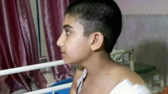 دست چپ پسر 11 ساله بهشهری قطع شد+فیلم و عکس