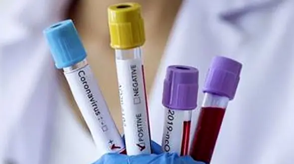 آمار مبتلایان به کرونا در آلمان افزایش یافت