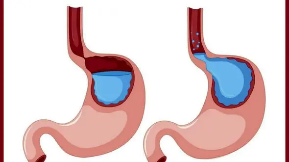 معده ات را گرم کن تا لاغر شوی!
