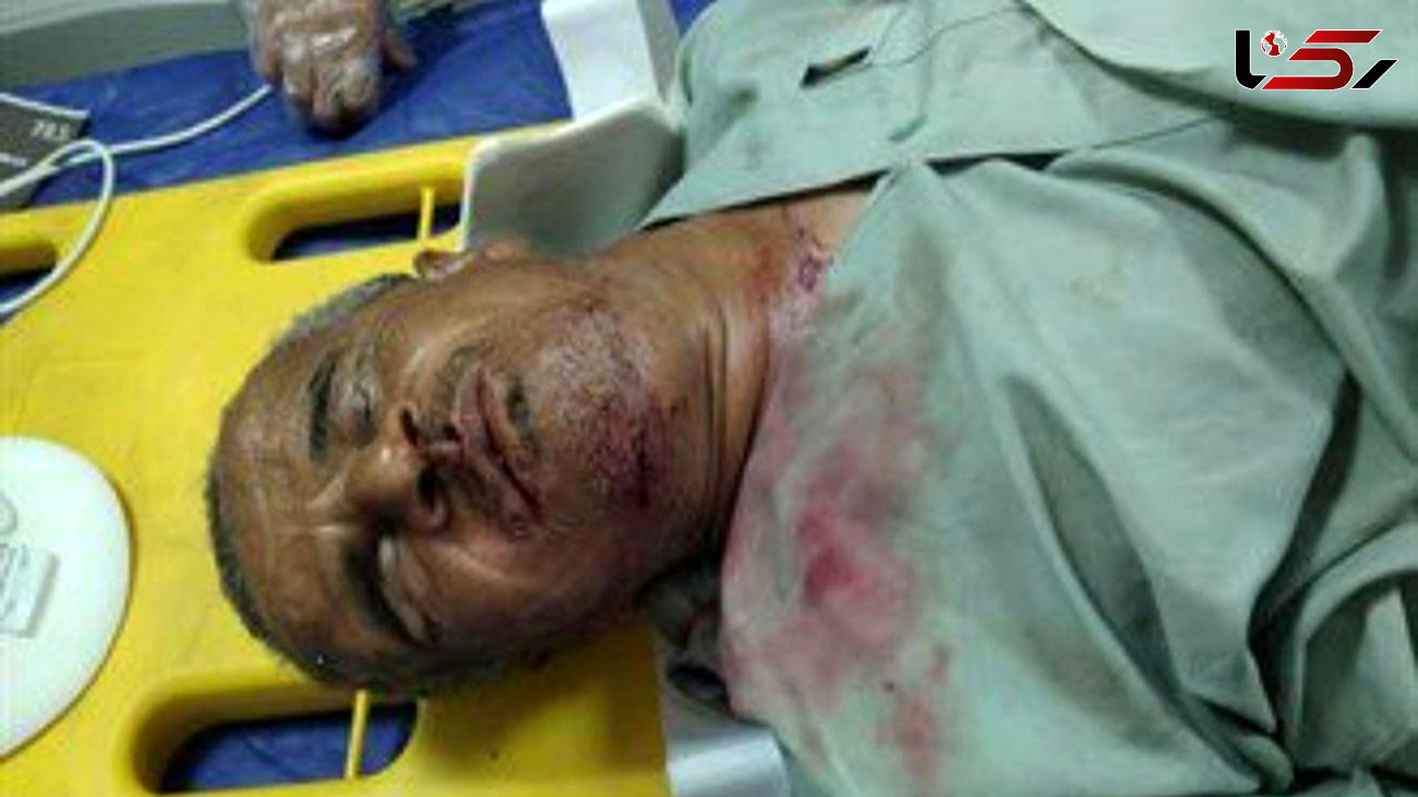 سقوط مرد نابینای چابهاری از پل عابر پیاده بدون حفاظ+ عکس