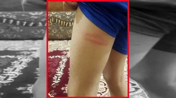 تنبیه بدنی دانش‌آموزان در بندرماهشهر توسط ناظم !