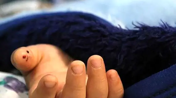 کودک آزاری مرگبار پسر 2 ساله در تهران ! / بازپرس جنایی وارد عمل شد