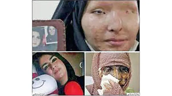 پشت پرده اسیدپاشی هولناک یک زن روی سیما افشاری  در دهدشت / انگیزه چه بود؟ + عکس