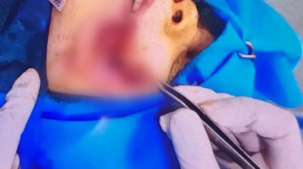 سگ ولگرد جان یک کودک دیگر را در ایران گرفت/ افزایش طوفانی آمار ابتلا به هاری در کشور / نجات مبتلایان حتی با واکسن هم نادر است