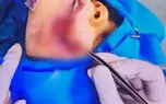 سگ ولگرد جان یک کودک دیگر را در ایران گرفت/ افزایش طوفانی آمار ابتلا به هاری در کشور / نجات مبتلایان حتی با واکسن هم نادر است