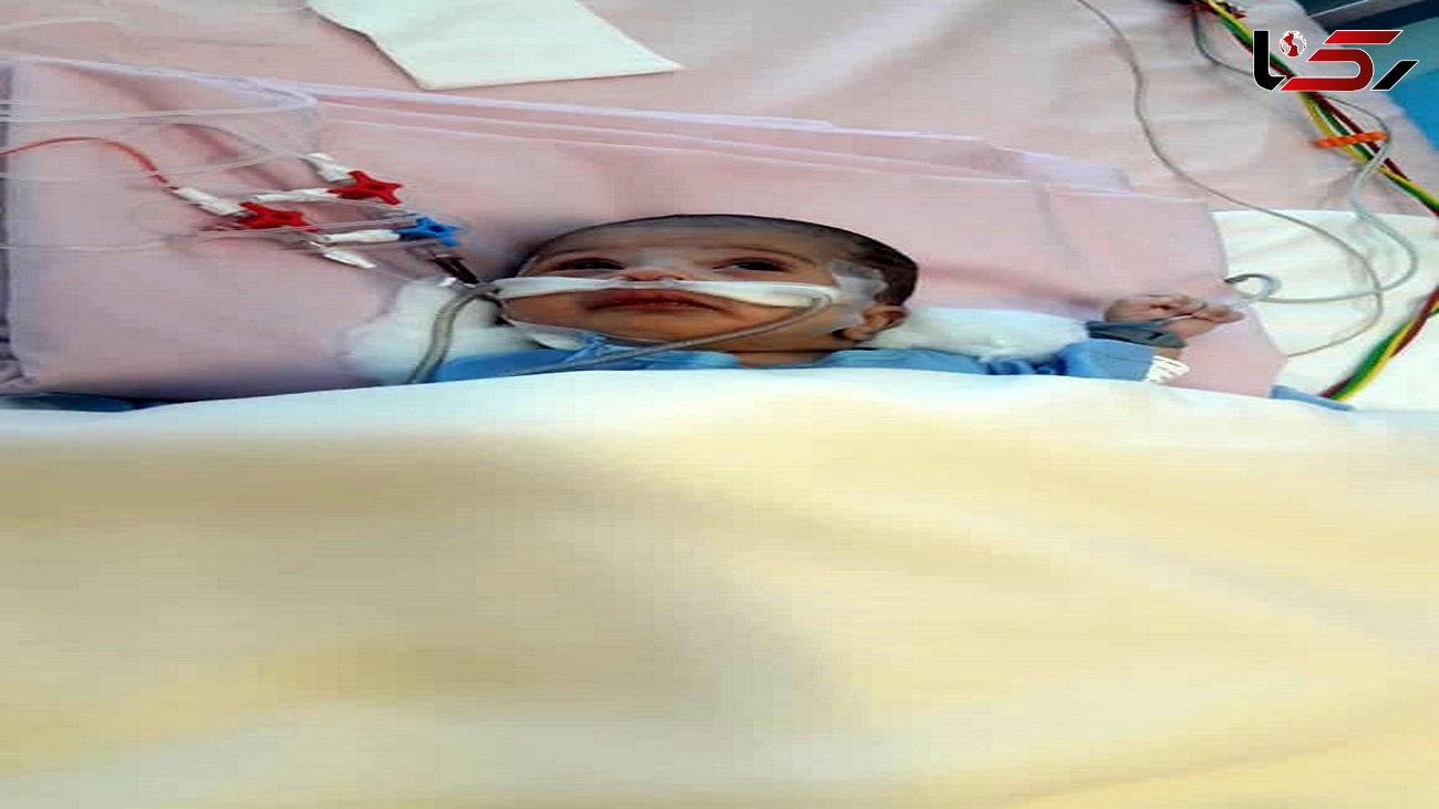 جراحی قلب باز نوزاد 26 روزه در بیمارستان رضوی مشهد