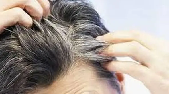 سفیدی مو زنگ خطر یک بیماری خطرناک در مردان