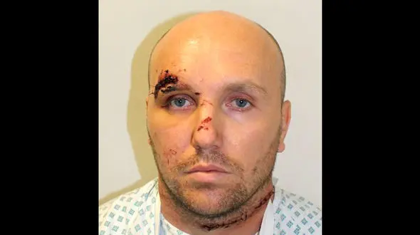 بلایی که یک ماه قبل از زایمان سر زن باردار آمد+عکس