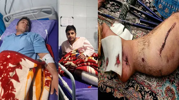  امیرحسین 20 ساله از مجروحان جنگ ۱۲روزه در انفجار پهپاد : به دادم برسید ../ رهایم کرده اند .../ حمایتم نمی کنند .../ جانبازی ام ..../ قرار بود درمان هایم رایگان باشد اما ...