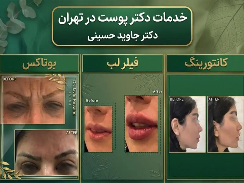 خدمات پوست، مو و زیبایی دکتر جاوید حسینی
