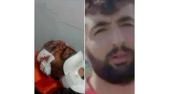 مرگ تلخ کولبر پاوه ای + عکس قبل و بعد از مرگ