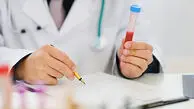 تشخیص زودهنگام آلزایمر با آزمایش خون؛ امیدوارکننده اما هنوز نه برای همه