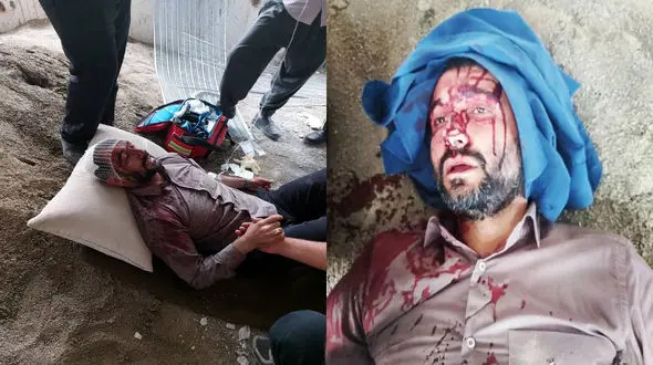 دستگیری یک نفر در ماجرای ضرب و شتم شهردار ناحیه ۳ منطقه ۱۹