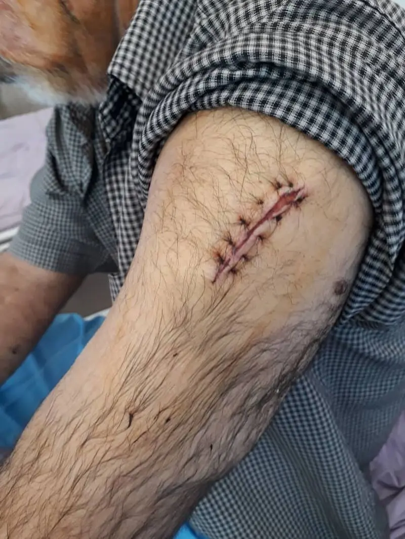 حمله به پیرمرد