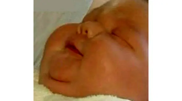 تولد نوزاد ۵ کیلویی در مشگین‌شهر