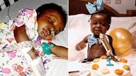 Miracle baby survives liver transplant and Covid-19 to celebrate 1st birthday