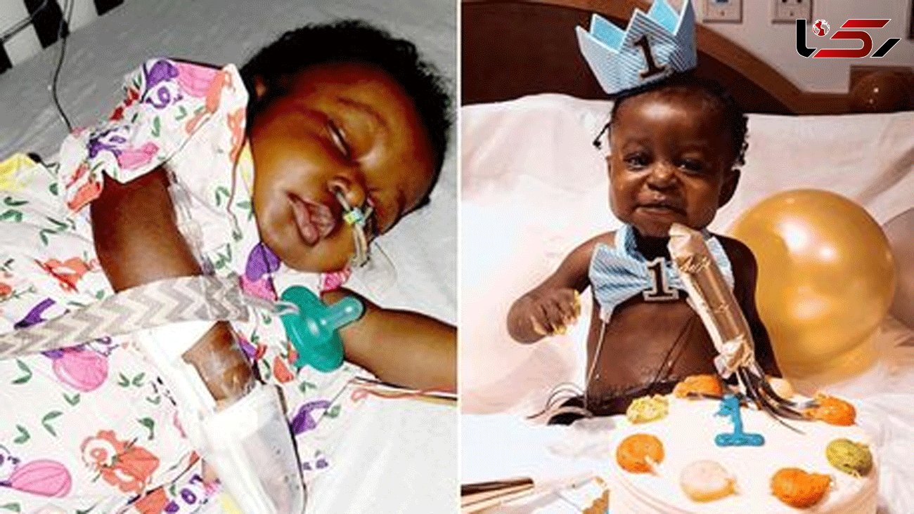 Miracle baby survives liver transplant and Covid-19 to celebrate 1st birthday