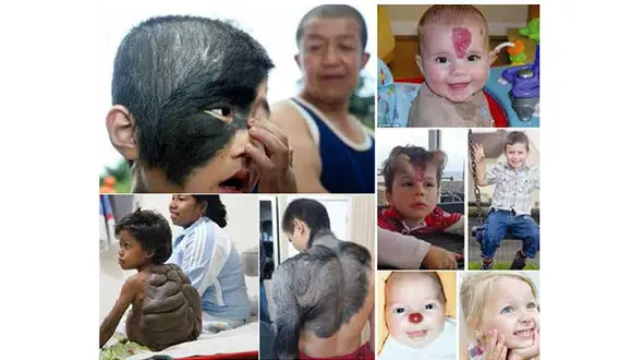 عجیب ترین انسان‌های دنیا / از مرد گرگ نما تا زنی با گوش دوقلو + تصاویر