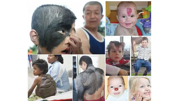 عجیب ترین انسان‌های دنیا / از مرد گرگ نما تا زنی با گوش دوقلو + تصاویر