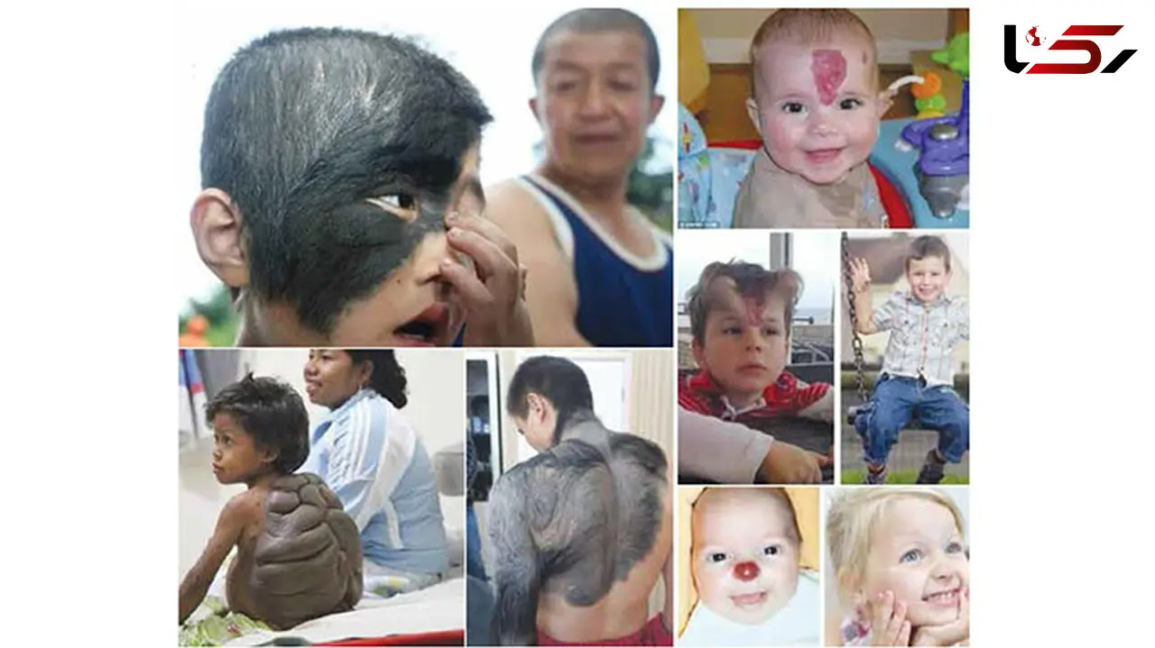 عجیب ترین انسان‌های دنیا / از مرد گرگ نما تا زنی با گوش دوقلو + تصاویر