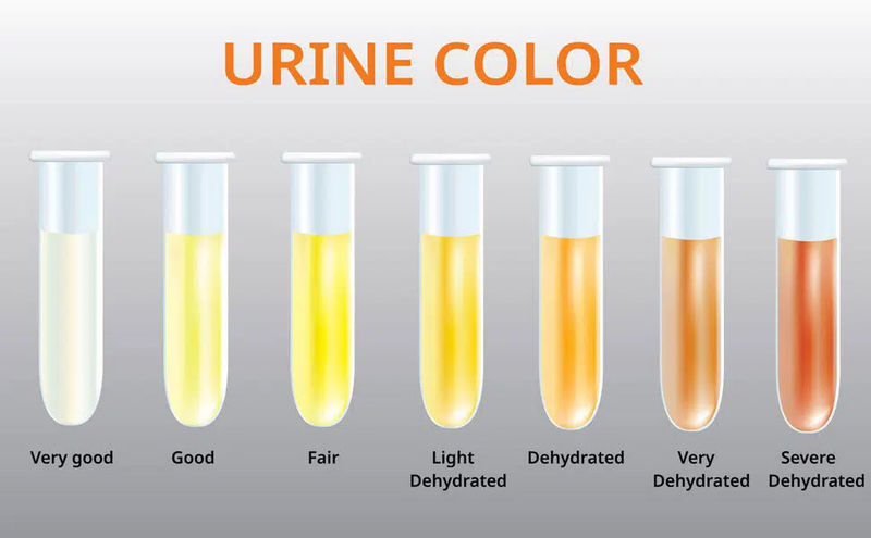 specific gravity در آزمایش ادرار