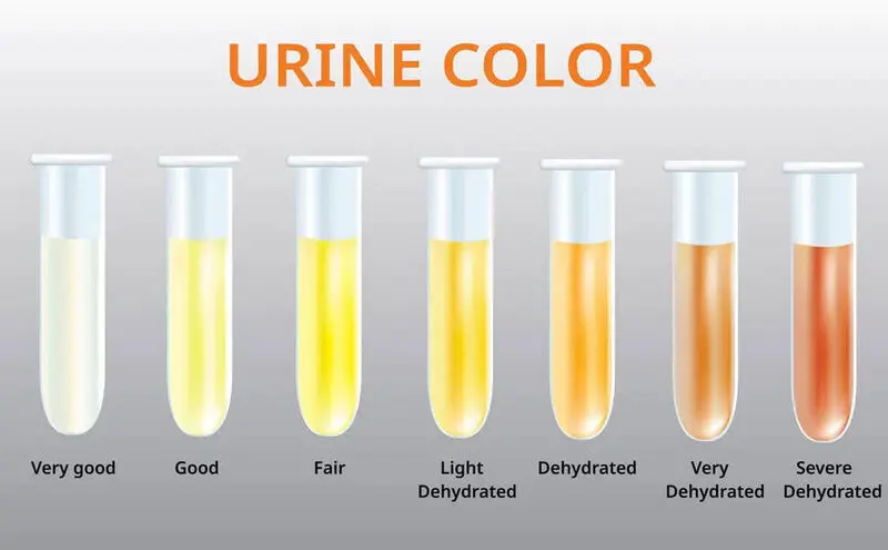 specific gravity در آزمایش ادرار