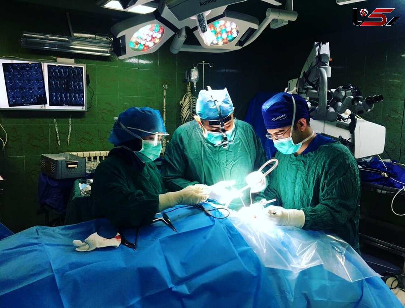 انجام نخستین عمل جراحی ترمیم کف جمجمه در تربت جام