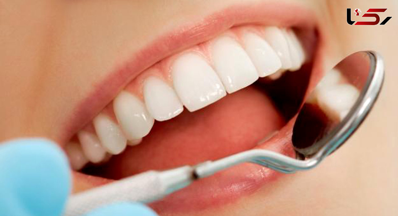 کدام روش ترمیم دندان مفیدتر است؟