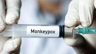 اعلام وضعیت اضطراری در آمریکا به دلیل شیوع آبله میمون