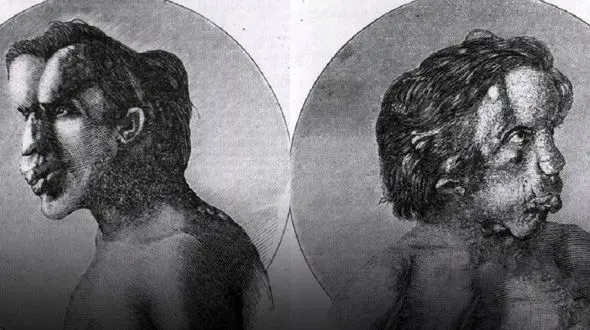 کشف بقایای زشت ترین مرد دنیا در یک قبر بدون اسم در لندن +عکس