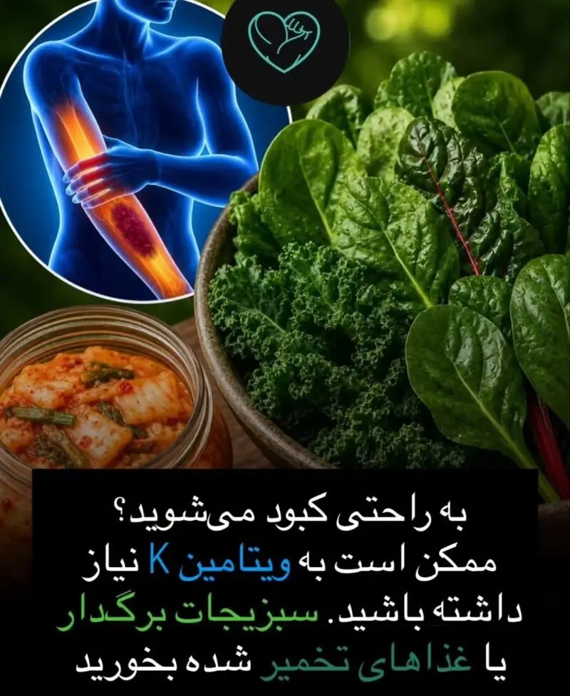 غذای کبودی