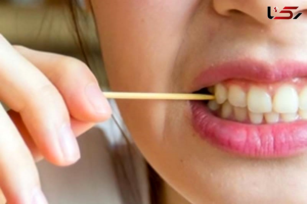 پوسیدگی دندان عامل بروز چه بیماری هایی است؟