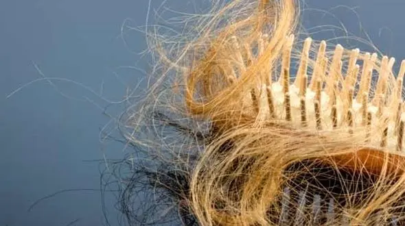 کشف علل ریزش مو مردان