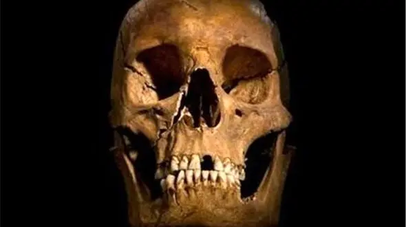 پیدا شدن جمجمه عصر آهن در خیابان ظهیرالسلام تهران