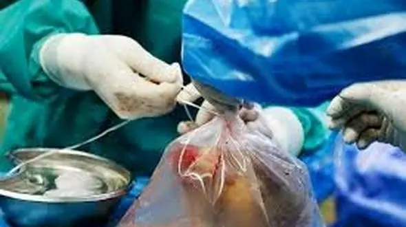 اهدای اعضای بدن کودک ۶ ساله ازنایی، به ۲ بیمار زندگی بخشید