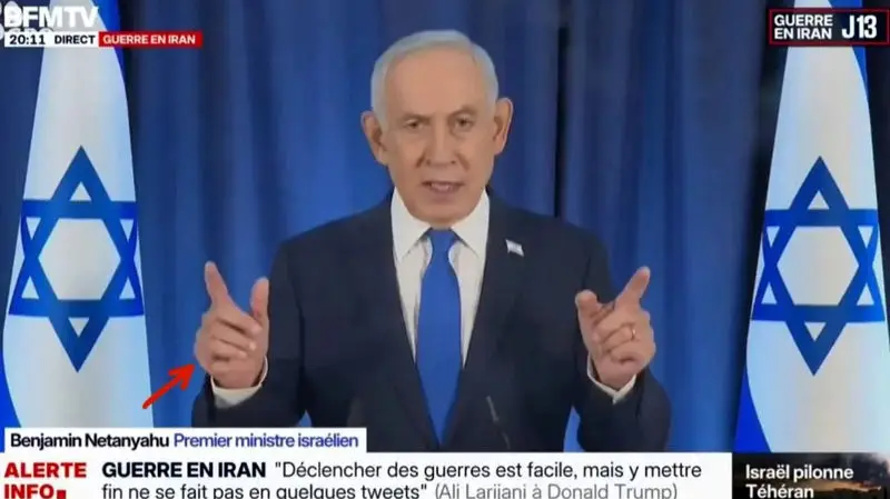 انگشت ششم نتانیاهو