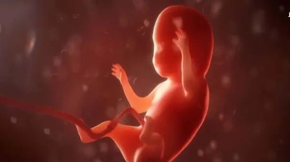 جلوگیری مجلس از سقط جنین ناقص الخلقه