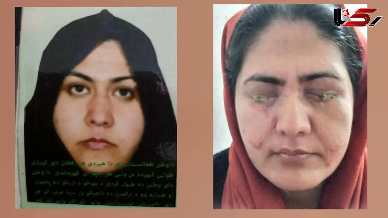 Rokna Campaign to Support an Afghan Woman in South Tehran / Marjan is a Victim of Her Brother’s Acid Attack! + Video