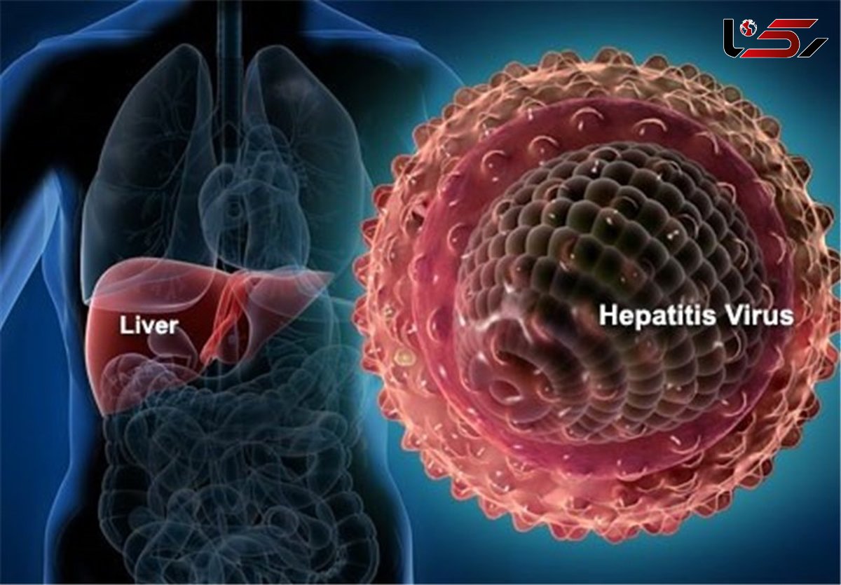 ۹۰ درصد مبتلایان به هپاتیت از بیماری خود بی‌خبرند/ مرگ خاموش جان یکی میلیون نفر را در جهان می گیرد