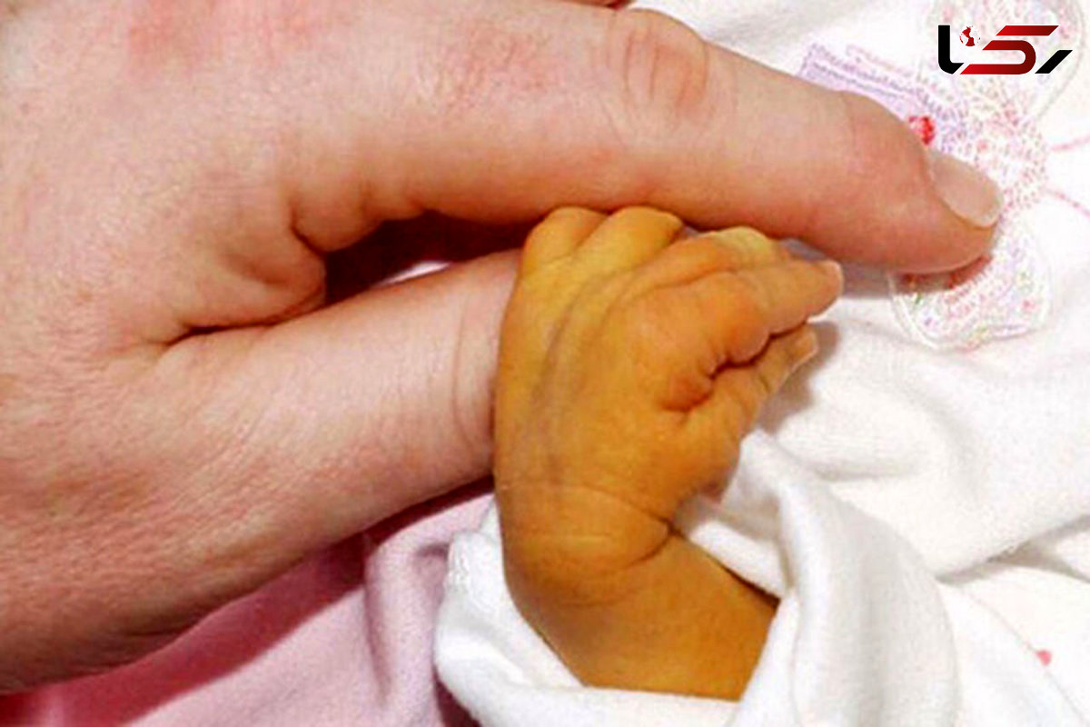 به دنیا آمدن نوزادی عجیب الخلقه + عکس حیرت آور