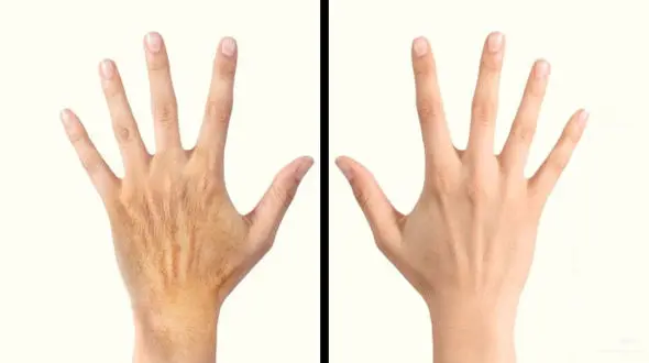 ترفندهایی برای روشن کردن پوست دست و پا