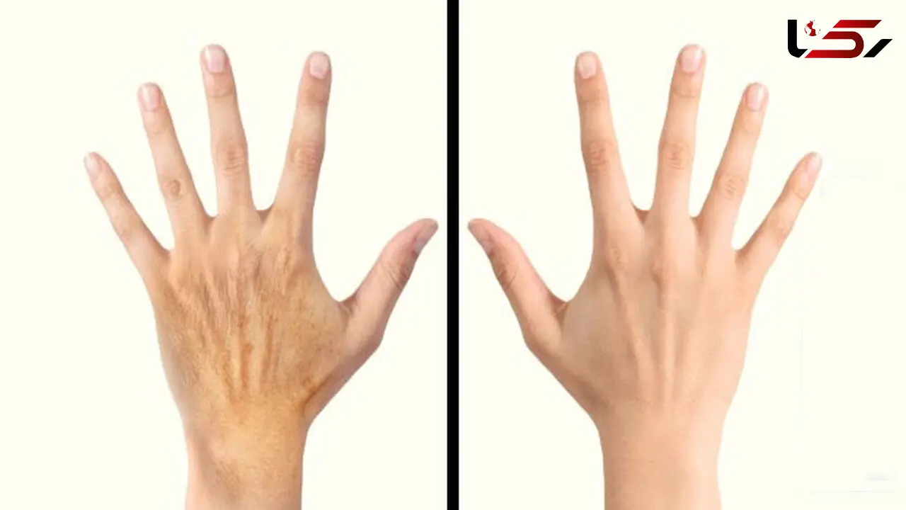 ترفندهایی برای روشن کردن پوست دست و پا