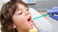 علت پوسیدگی های دندانی زودرس در کودکان چیست؟