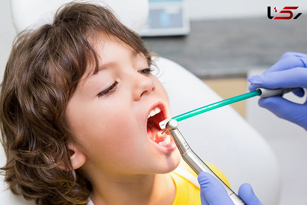 علت پوسیدگی های دندانی زودرس در کودکان چیست؟
