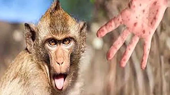  آبله میمون تاکنون در چه کشورهایی مشاهده شده است؟