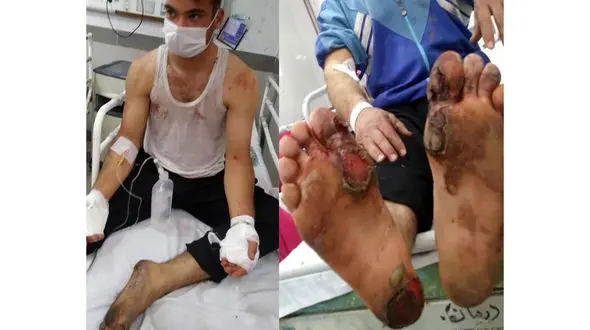 عکس 14 + / درگیری شدید پدر و پسر گیلانی با سارق برق