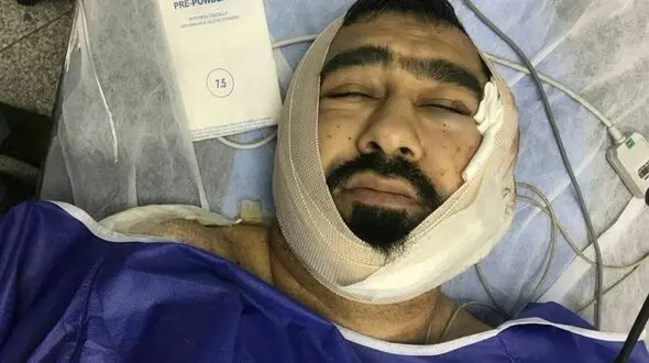 حمله وحشیانه جوان شیطان پرست با قمه به یک روحانی در شرق تهران + عکس 